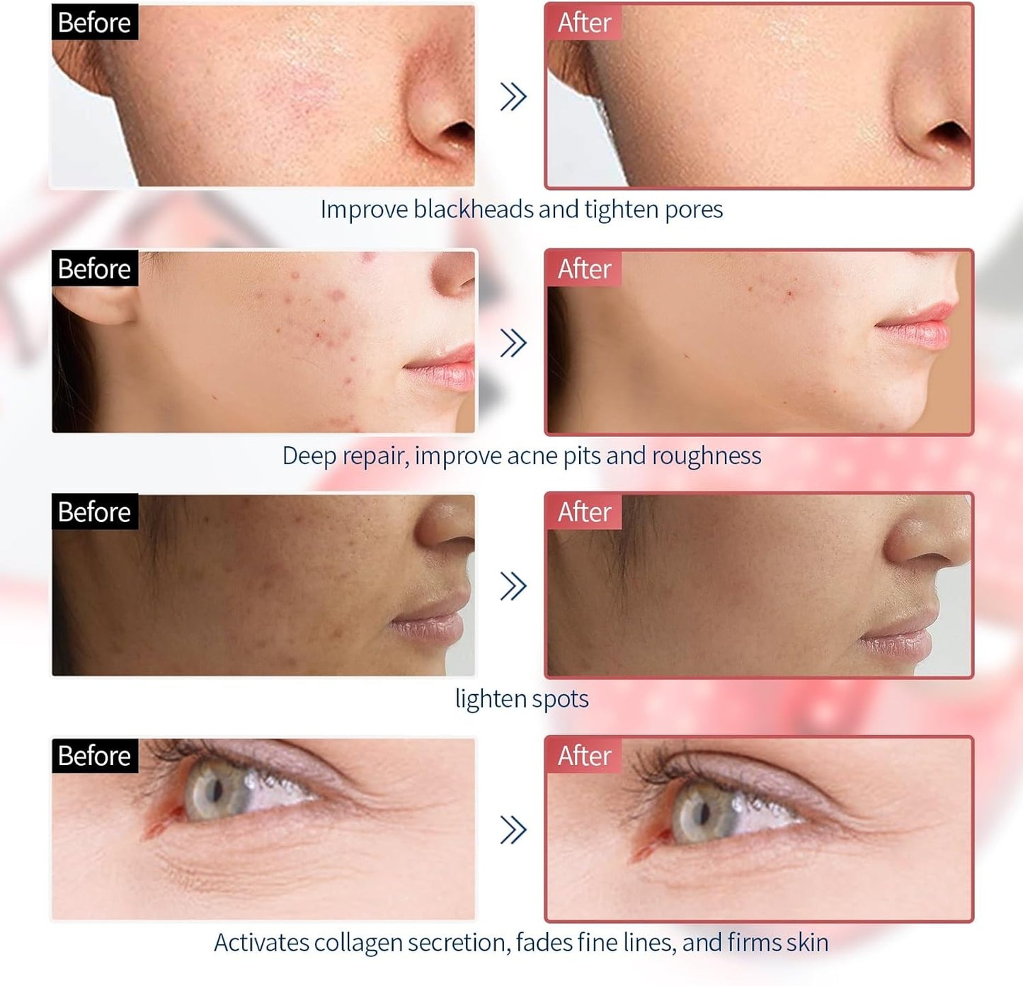 Masque De Beauté Sans Fil, Masque Lumineux 7 Couleurs Avec 270 Perles, Masque Lumineux Rechargeable Pour La Beauté Du Visage